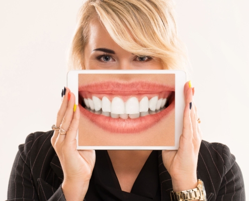 Clínica Reyes de Navarra - Blog - Carillas dentales - Mujer rubia con carillas dentales