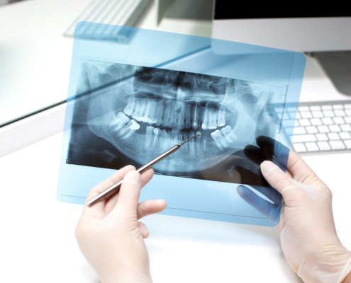 revisión radiografía dental