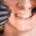 ortodoncia dental brackets