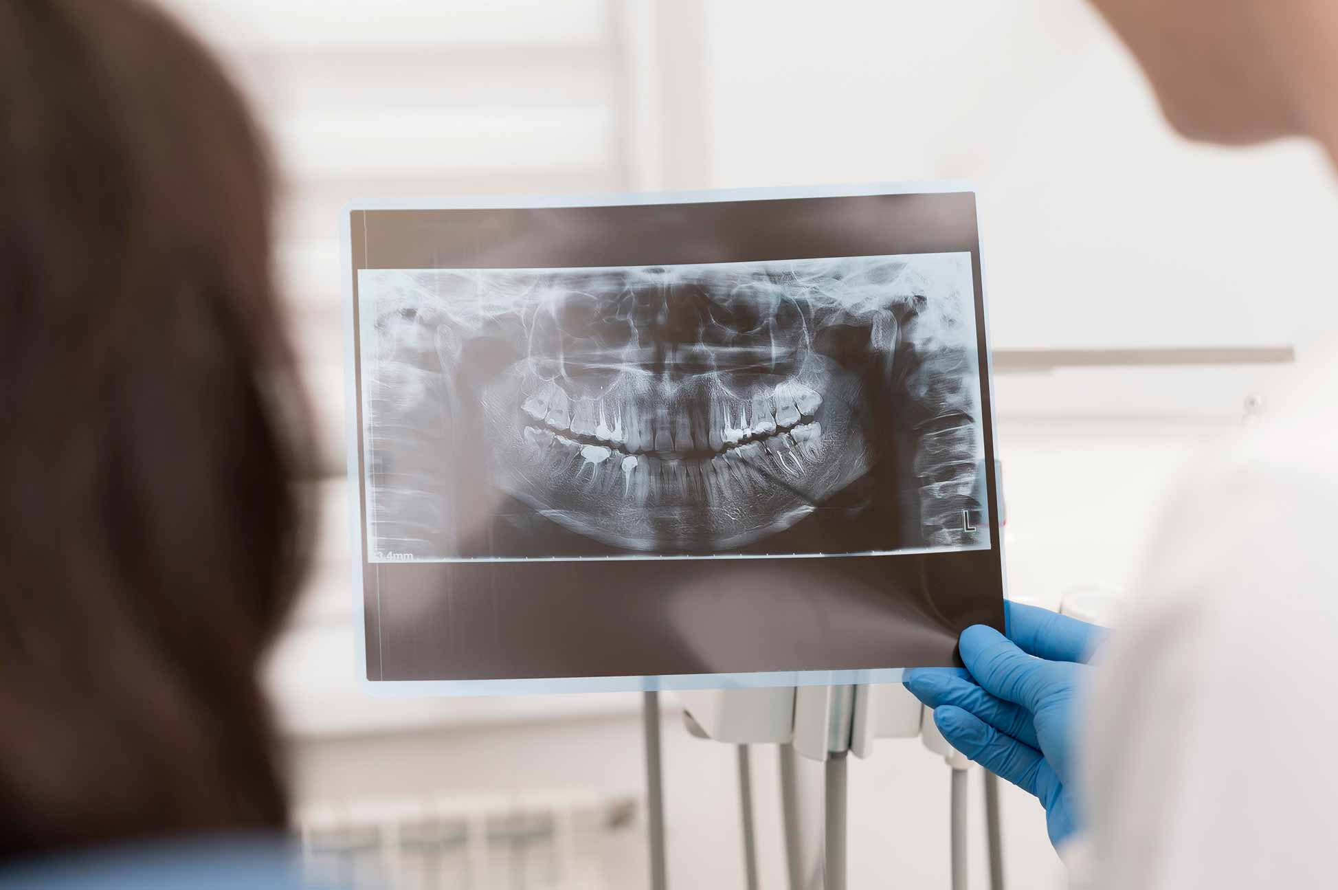 Dentista enseña radiografía de sus dientes a su paciente