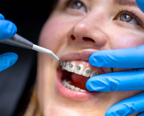 Dentista colocando ortodoncia a una paciente